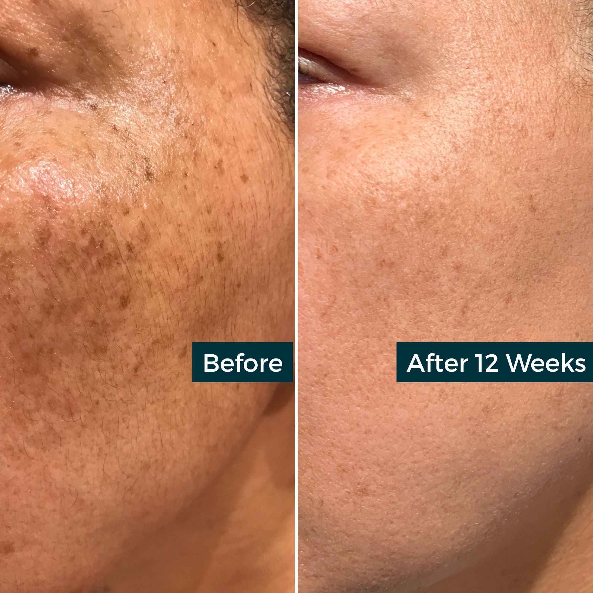 Retinol Plus Vitamin C Skin Refining Night Oil